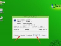 Wind10系统安装教程（详细教你如何在电脑上安装Wind10系统）